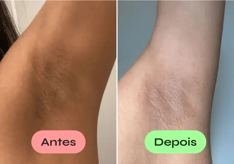 Depoimento